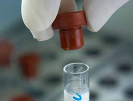Yeni HIV aşısı insan üzerinde denenecek Yeni HIV aşısı insan üzerinde denenecek